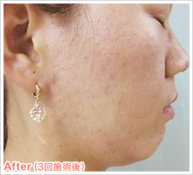 After