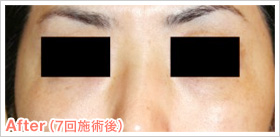 After