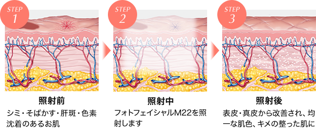 フォトフェイシャルの働き